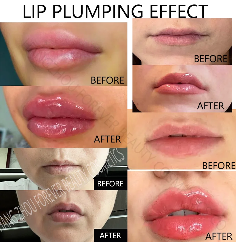 Lip volume hyaluronic acid custom ingredients lip plumper gloss private label