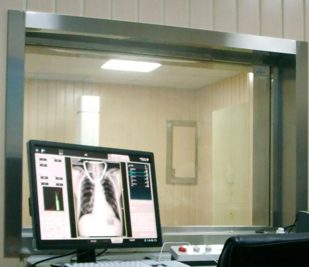 
lead glass ct scan radiation protection lead glass for medical with strict production 