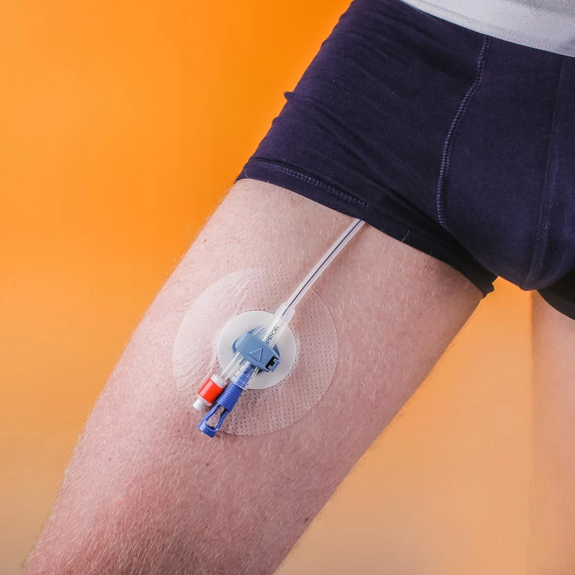 Silicone Foley Catheter Fixation Device Two-Way with Rotating Clip medical consumables