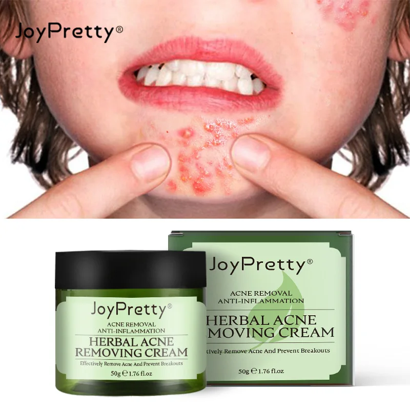 Wholesale Best Anti Acne Whitening Pimples Removal Face Acne Treatment Cream Herbal Acne Cream