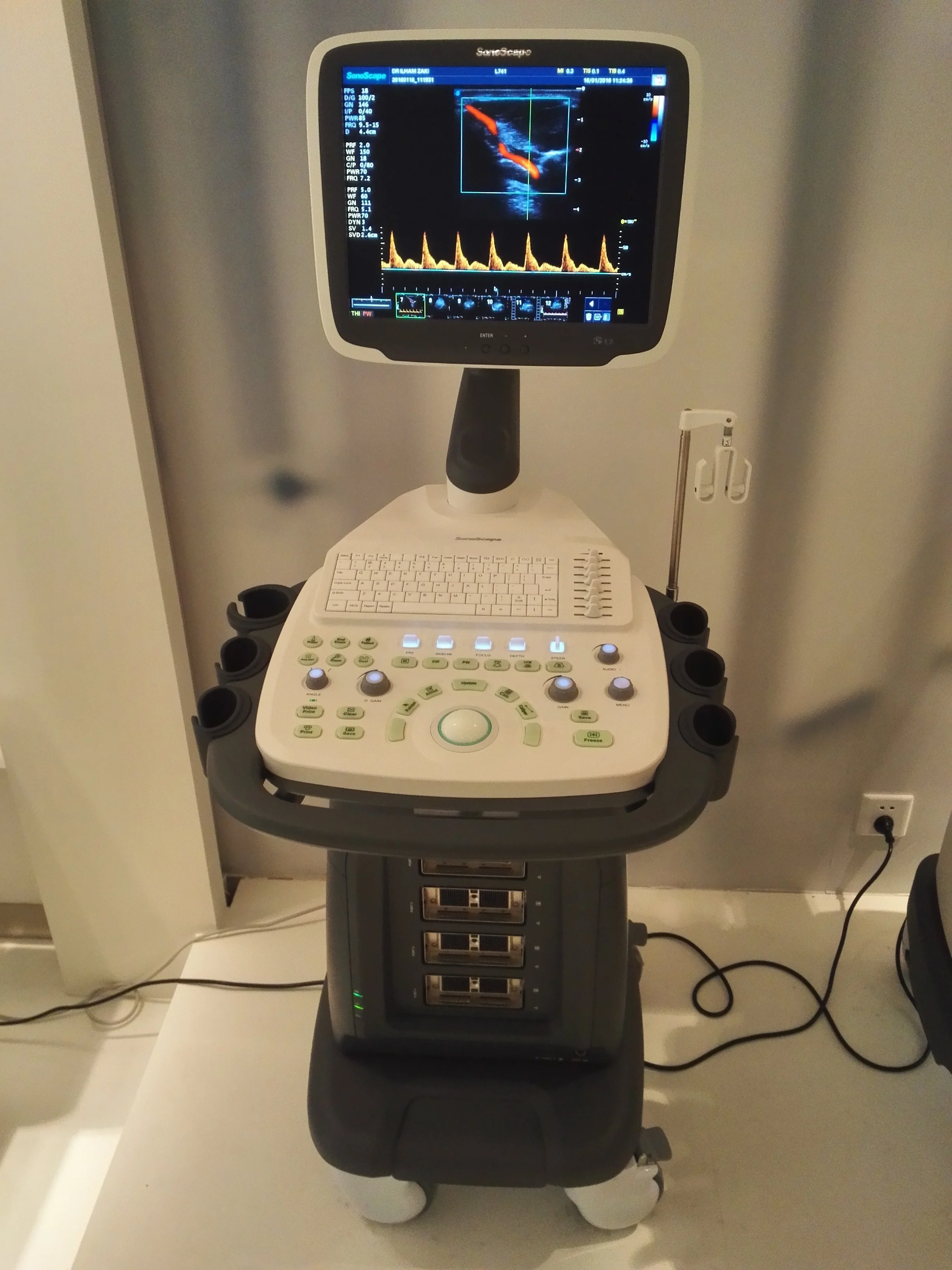 Sonoscape S12 4D Cart Color Doppler Human Ultrasound For Gynecology,Cardiovascular 15inch  LED monitor