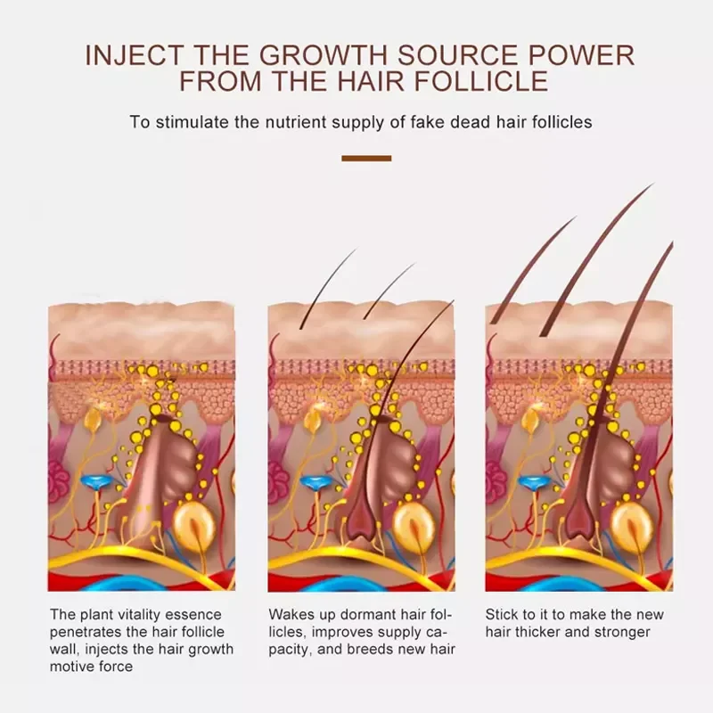 Natural Organic Private Label Vegan Treatment for Baldness Hair Growth Essential Oil Herbal Anti-Hair Loss Hair Growth Oil