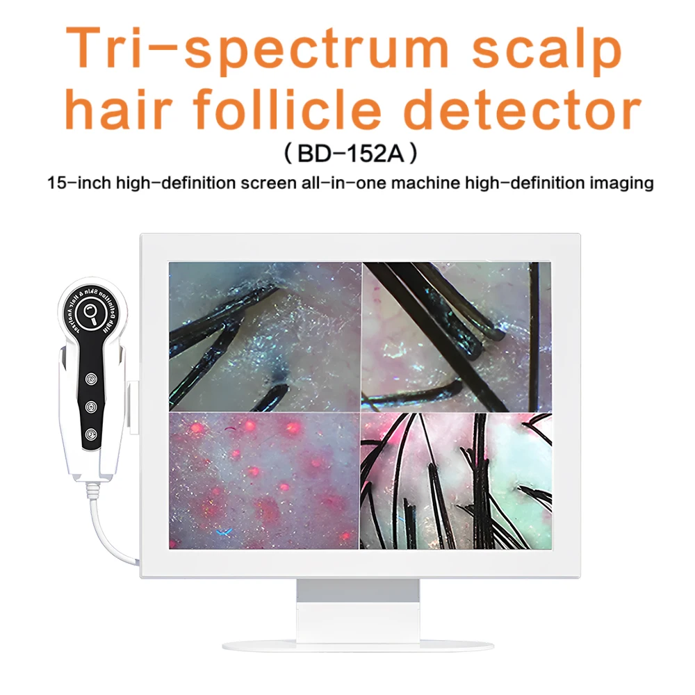 Home use 5 in 1 scalp hair analyzer beauty skin hair scalp detector analyzer professional beauty machine