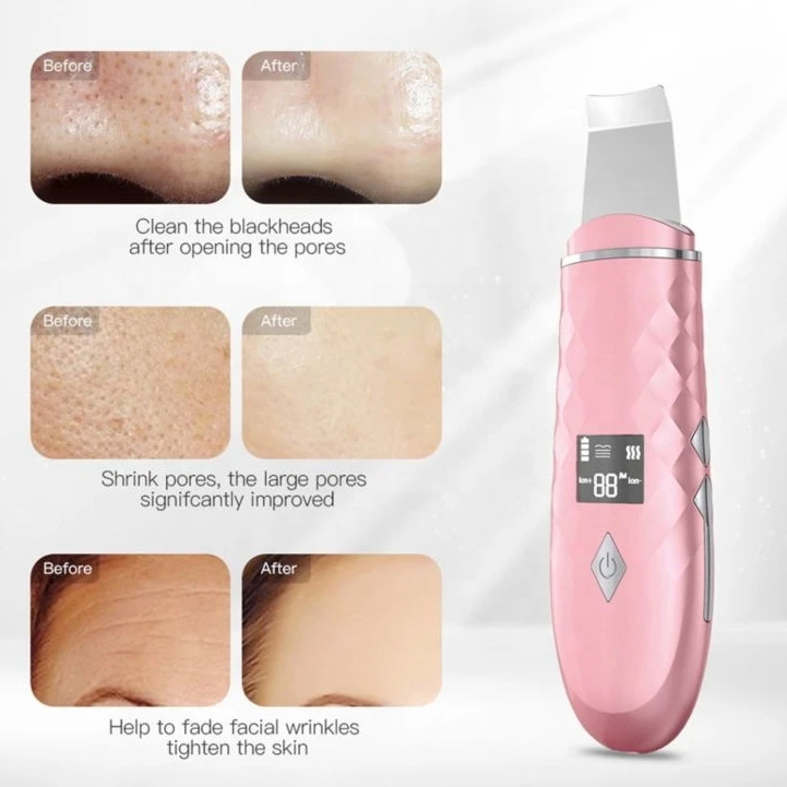 Biumart Skin Scrubber Portable Electric Face Skin Pore Cleaning Spatula Beauty Personal Care Machine For Vibration Exfoliating