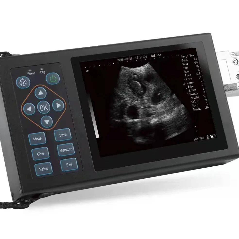 2025 Hot sell A10 full digital LED display veterinary ultrasonic diagnostic imagine system with 5 section frequency conversion