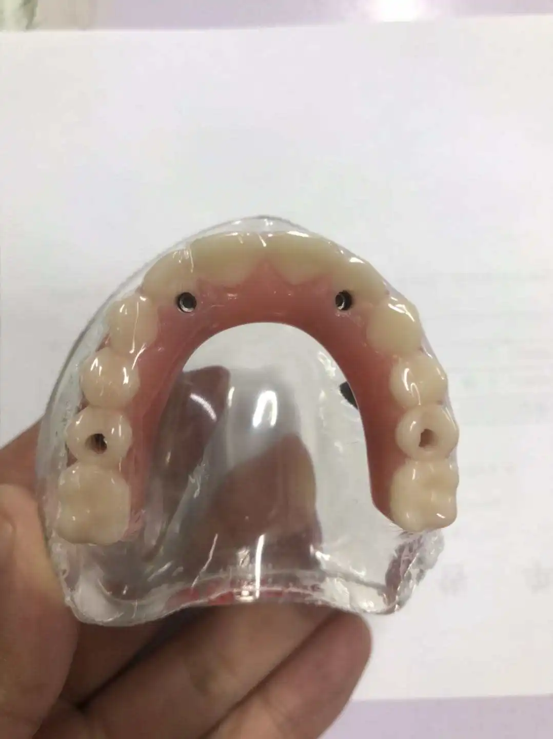 All on 4 speedy model  ALL-ON -4 implant model