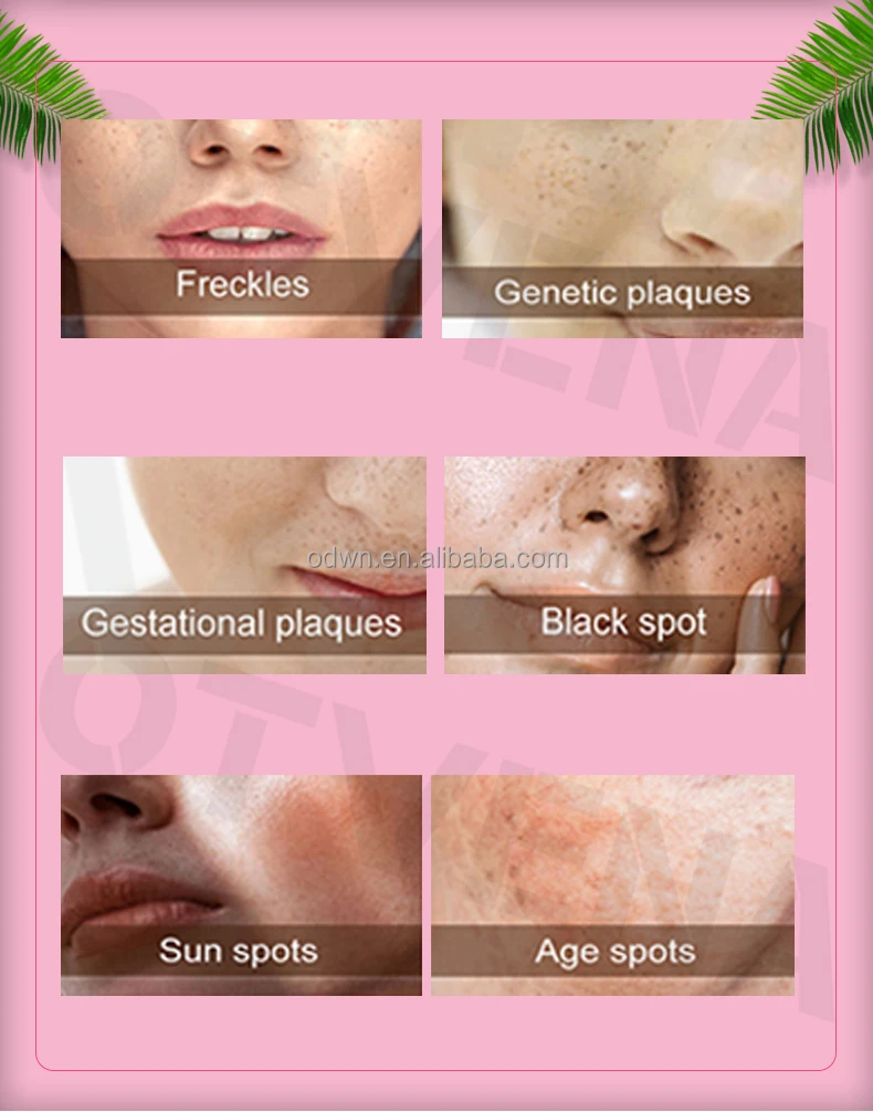 OEM Milk Dark Skin Whitening Cream High Performance Brightening Facial Cream Without Side Effects