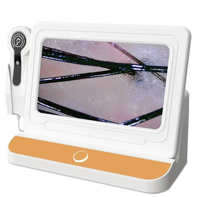 professional 10 inch screen scalp hair follicle detector SA-S19 hair follicle analyzer