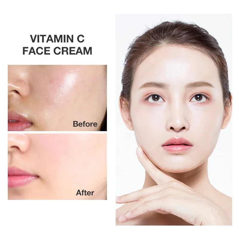 vitamin c skin whitening brightening lightening dark sopt pigmentation removal face cream