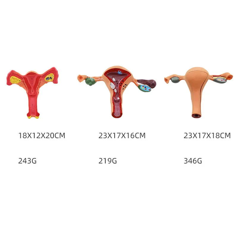 Female Plastic  Uterus Ovary Anatomical Model Vagina Model Normal/diseased Uterus Model