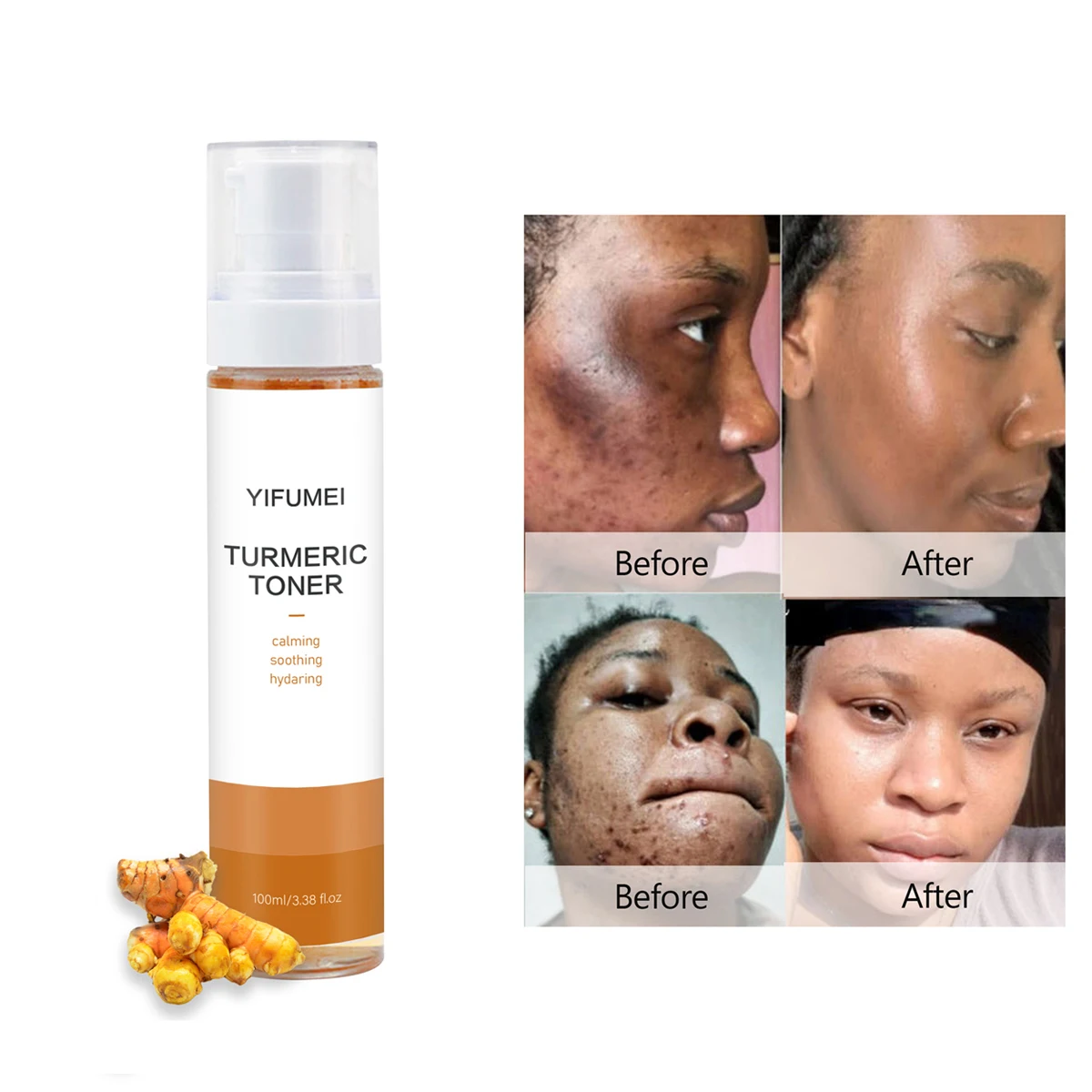 Hot Selling Natural Vitamin C Refershing Moisturizing Acne Mint Turmeric Whitening Facial Toner For Face