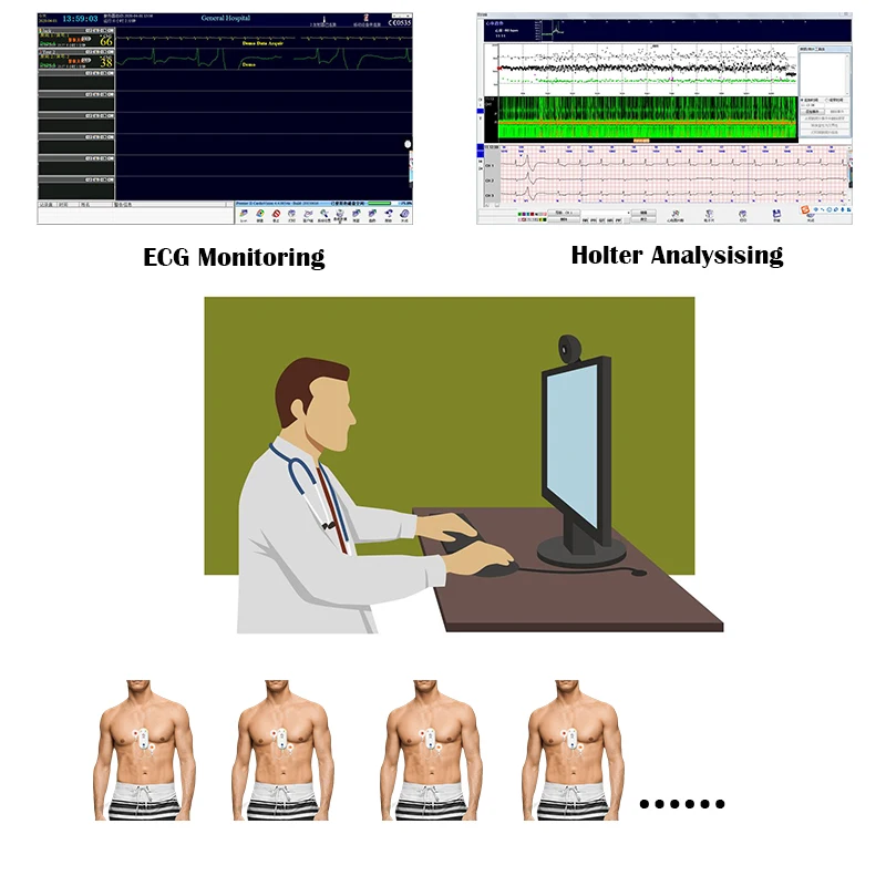 
DMS Latest telemedicine equipment remote Cardiac telemetry ecg monitoring system patch Holter 