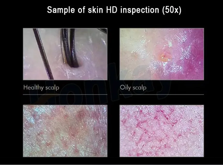 High-resolution 4k Imaging Hair Analyzer Hair Follicles Condition Analysis/Scalp Condition Scanner Detector