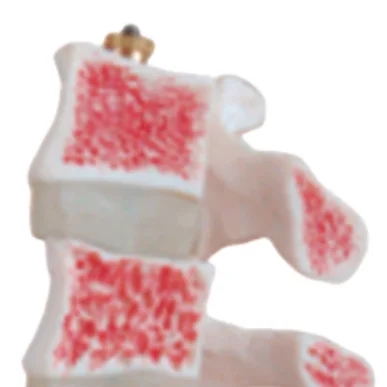 BIX-A1022 PVC Life-Size Human Anatomical Skeleton Osteoporosis Models for Medical School Training