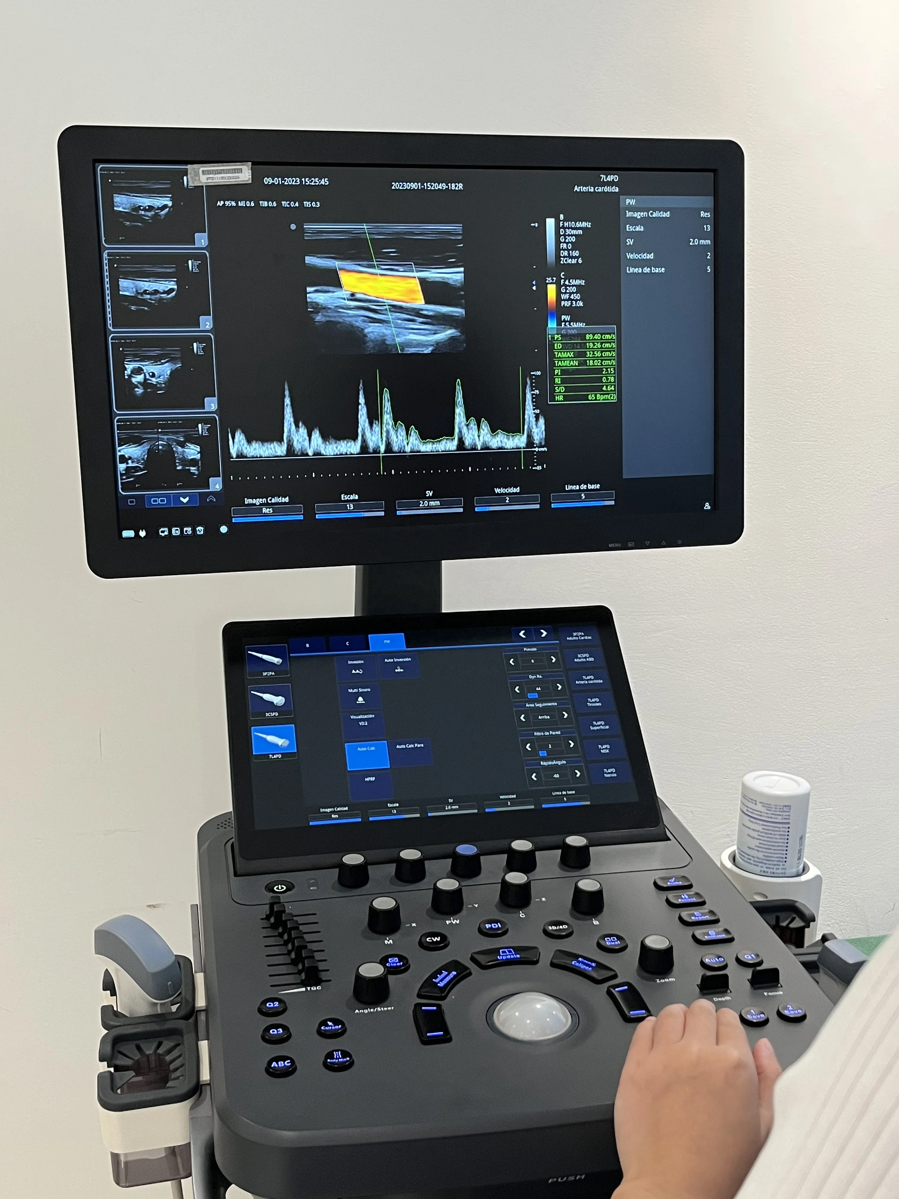 LTUB72 Medical Instruments 3D/4D Usg Machine 19 Inch Lcd Monitor Trolley Color Doppler Ultrasound