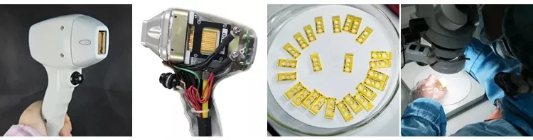 laser sopranosoprano ice alma laserAlma2_07