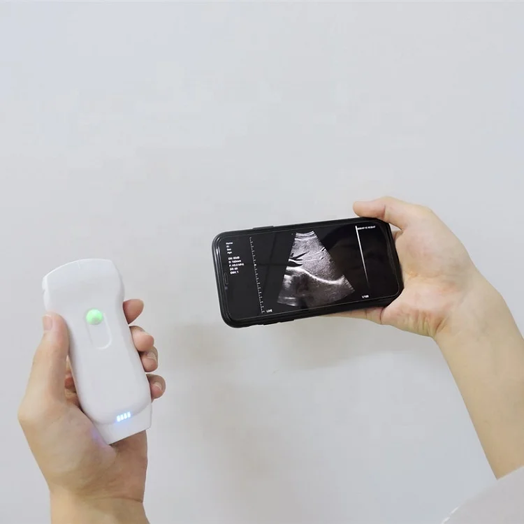 Medical Ultrasound Instruments Usg Portable Wireless Probe Electric Plastic Ce Color Doppler Ultrasound Price 256 Level Class II
