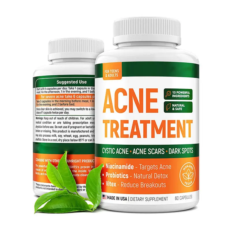 OEM / ODM Private Label Acne Pills for Teens & Adults Perfect Skin Capsules for Cystic Acne Hormonal Acne with Vitamin