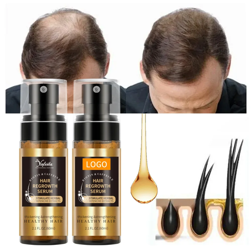 Factory Bulk 60ml Biotin Hair Growth Spray for Men and Women Fast Regrowth Treatment Serum to Stop Hair Loss