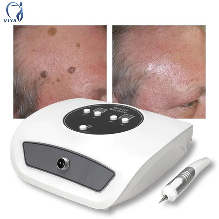 VY-5009 Mole removal pen Black Spot Cautery White Pimple Remover