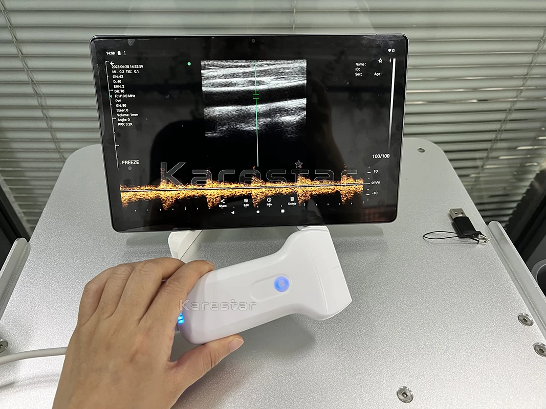 Handheld medical wifi wireless ultrasound probe scanner machine portable animals use wireless probe
