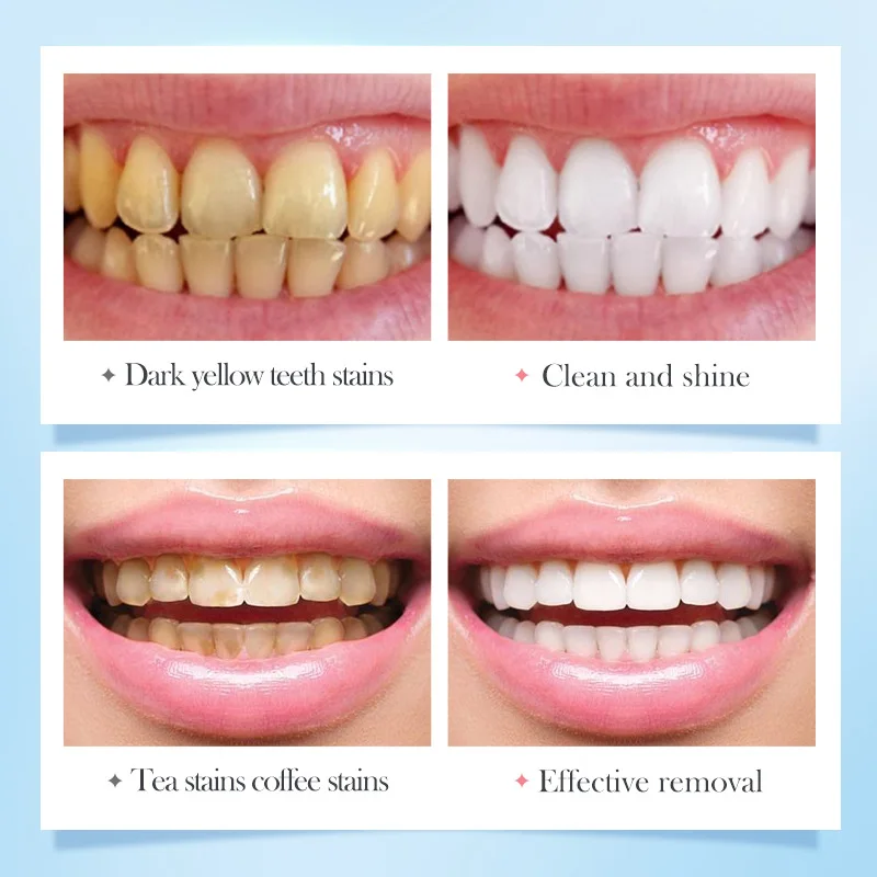 SADOER High Quality Oral Cleaning and Tooth Care Rose Salt Bright White Stain Removing Gingival Toothpaste