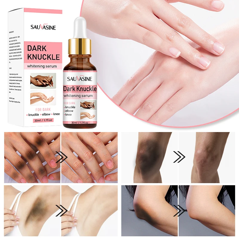 Dark Knuckles Bleaching Serum Sulfate-Free Nourishing Lightening and Vitamin C Double Glutathione Super Skin Whitening Serum