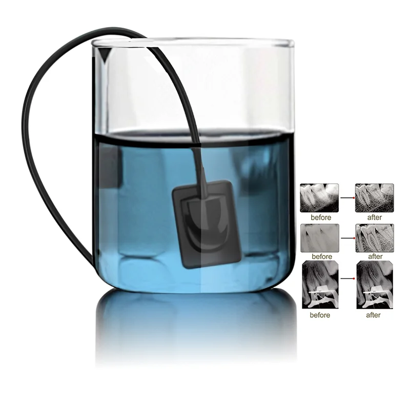 LK-C62 ветеринарная радиография с цифровой визуализацией рентгеновских зубных датчиков RVG