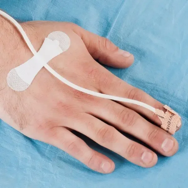 2*7cm Medical Supply Disposable Catheter Fixation Device Hemodialysis Catheter Picc /CVC Catheter