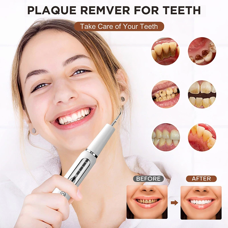 Oral Cleaning Teeth Whitening Tools Tartar Remover Tooth Cleaner Electric Ultrasonic Dental Calculus Remover