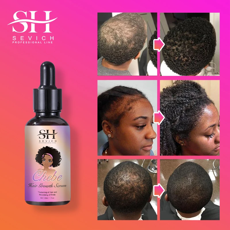 Private Label Chebe Product Hair Care Shampoo And Conditioner Hair Care Essential Oil Spray