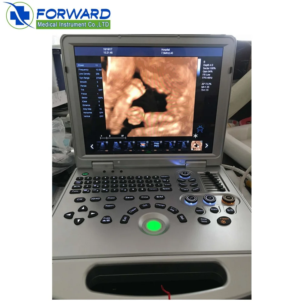 4D laptop portable color doppler ultrasound machine for human