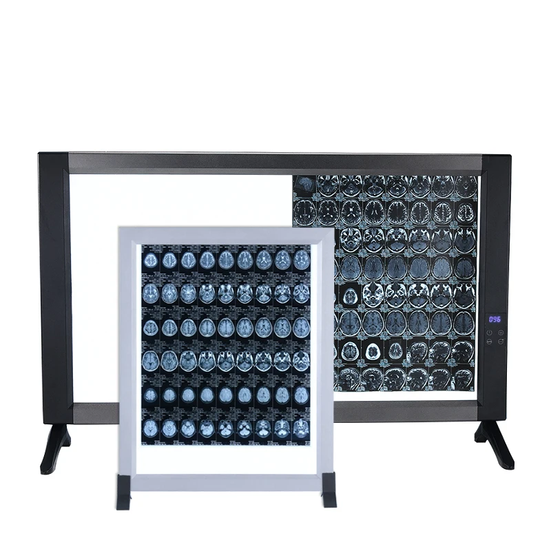 Hospital Negatoscope Xray Dental X-ray Film Viewer X-ray Viewing Box