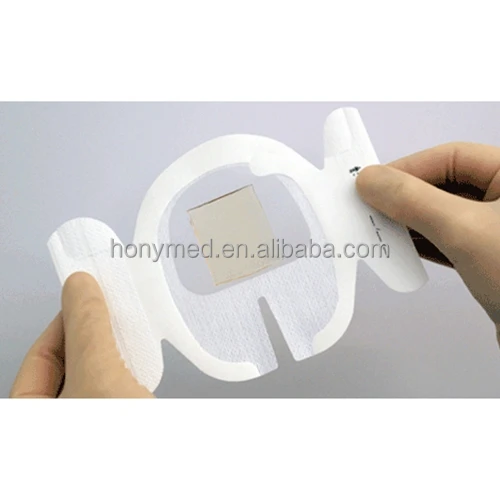 I.V. and Catheter Fixation Dressing-SecureFix with CHG pad