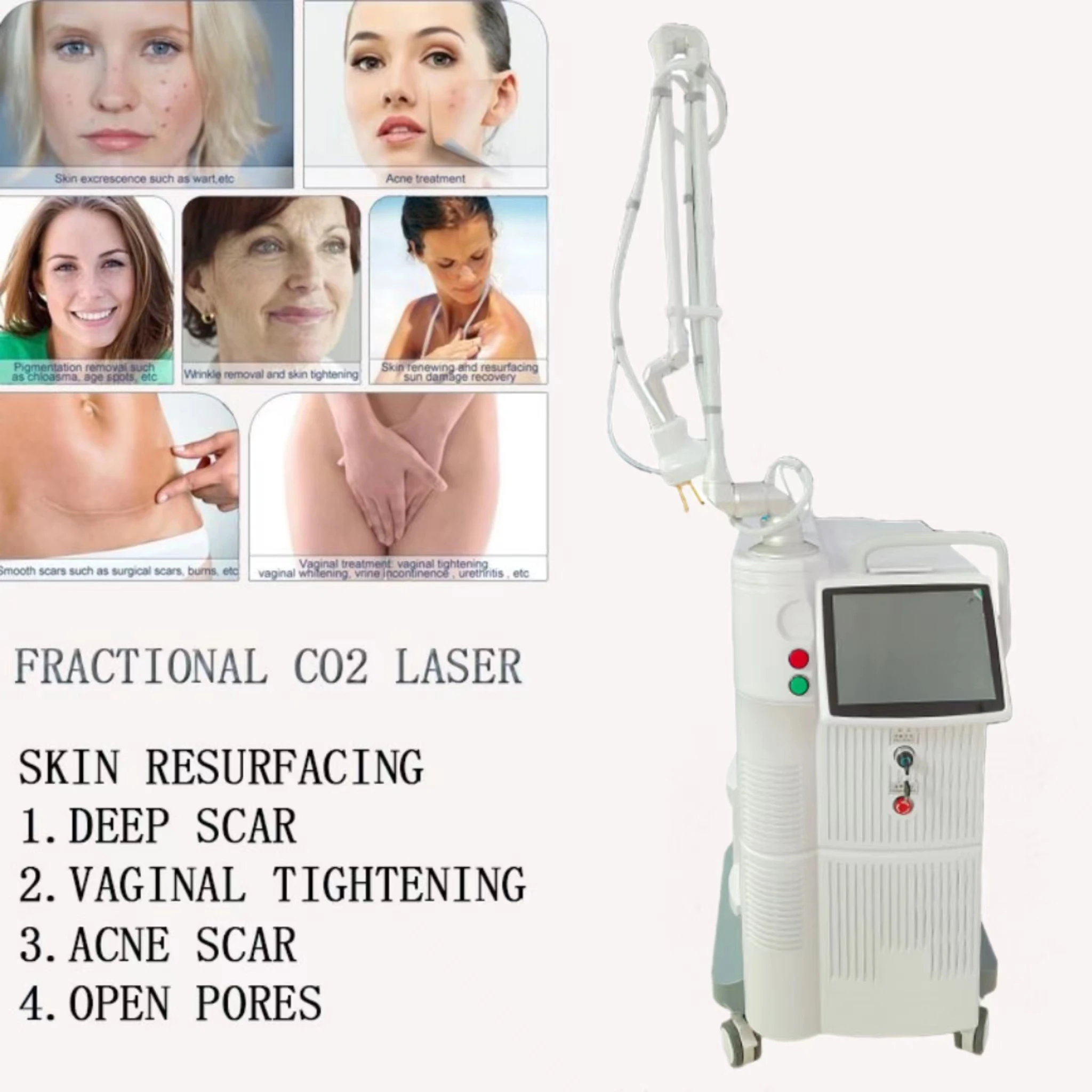 60w co2 Fractional Laser for Vaginal Treatment Machine Fractionated Co2 Laser Acne Scars Vaginal Rejuvenation