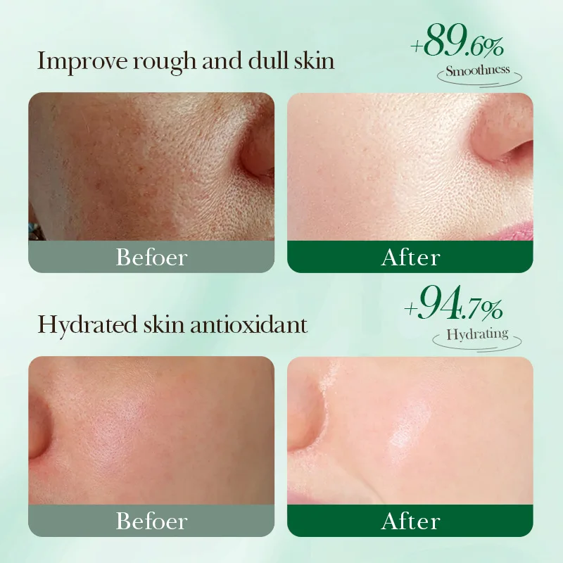 SADOER Wholesale Aloe Hydrating Repairing Lyophilised Powder Lysosomal Solution Repairing Acne Skin Brightening Moisturizing