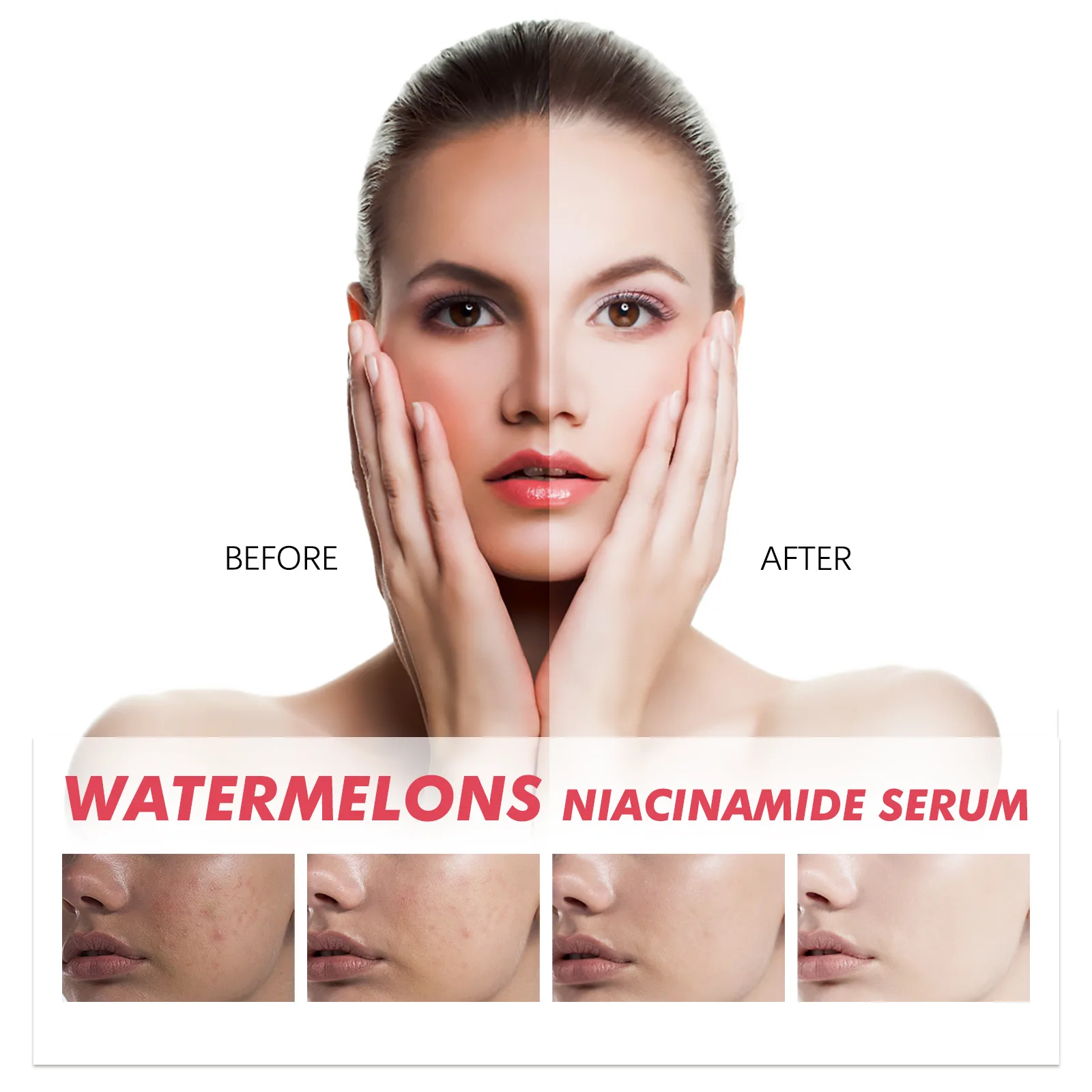 Hot Selling High Quality Skin Facial Care Hydrating Moisturizing Brightening Serum Watermelons Nicotinamide Serum For Face