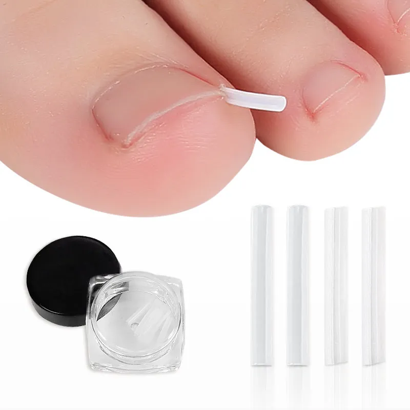 Long Meat Filling Strip Nail Correction Device Manicure & Pedicure Set with Inlay Pad & Wire for Toenail Nail Groove Correction