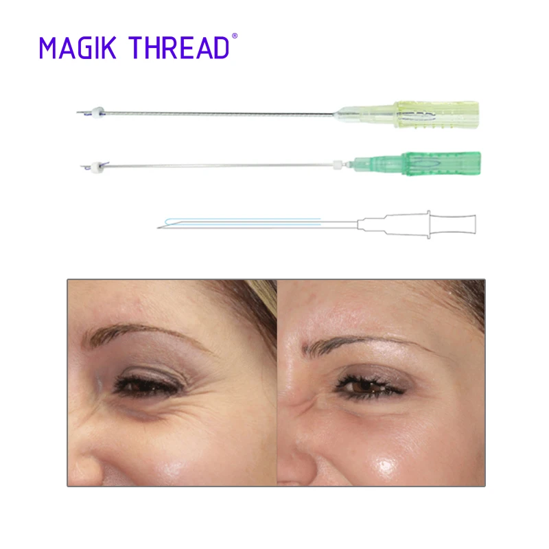 Magik Thread CE marked MONO 29g 60mm pdo face lifting thread single kits for buttock and breast with sharp needle