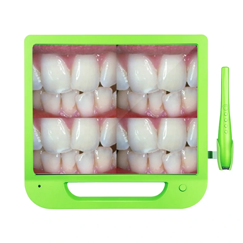 
8.0 mega Pixel camera intra oral dental 3d scanner camera intra-oral 