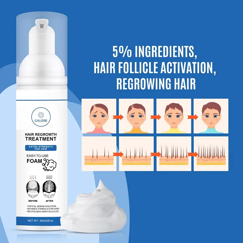 Foam for Anti Hair Loss and Hair Regrowth Topical Treatment Solution Botanical for Thinning Hair 60ml Biotin 1-Month Supply