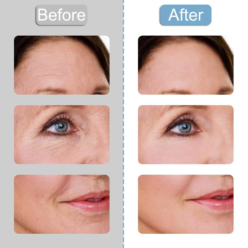  Eco-friendly Organic Material Cleanable Transparent 5IN1 Anti Wrinkle