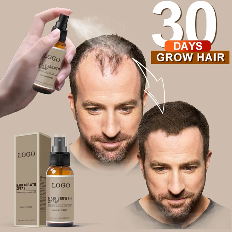 OEM New Hair Growth Spray Fast Grow Hair loss Treatment For Thinning Hair Care 30ml