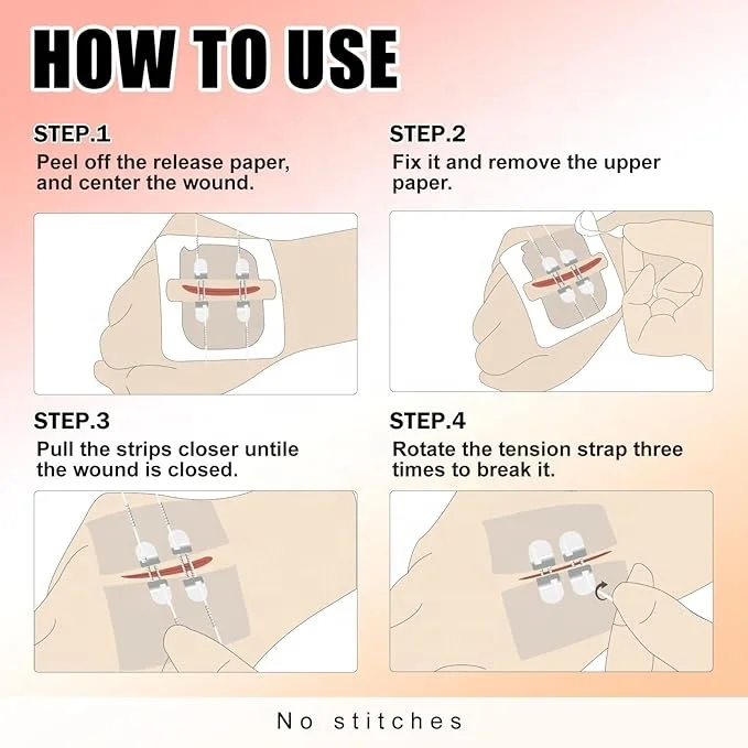 Waterproof Large Butterfly Wound Closure Strips Surgical Sterile Adhesive Wound Skin