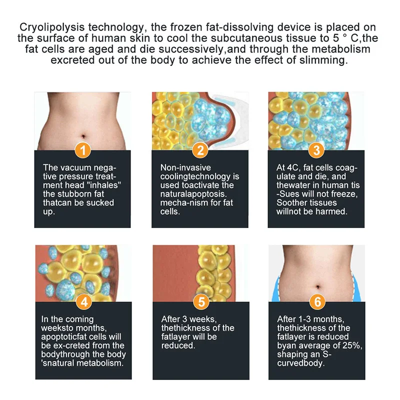 Popular Cryo Cool EMS Slimming 4 Therapy Pad Cryolipolysis Machine