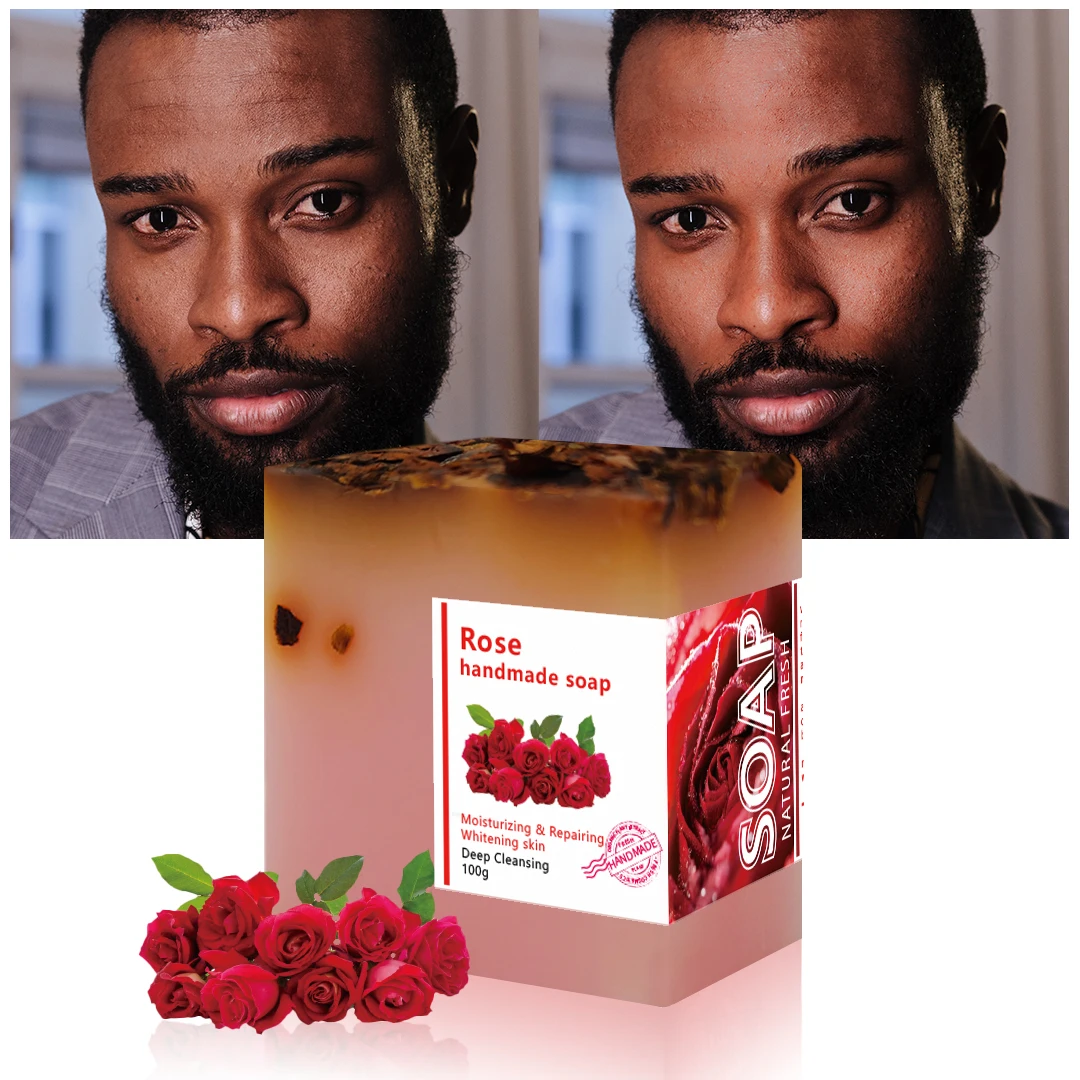 DYM Soap Wholesale Organic Natural Private Label Bleaching Soap Solid Kojic Acid Soap For Skin Whitening Lightening