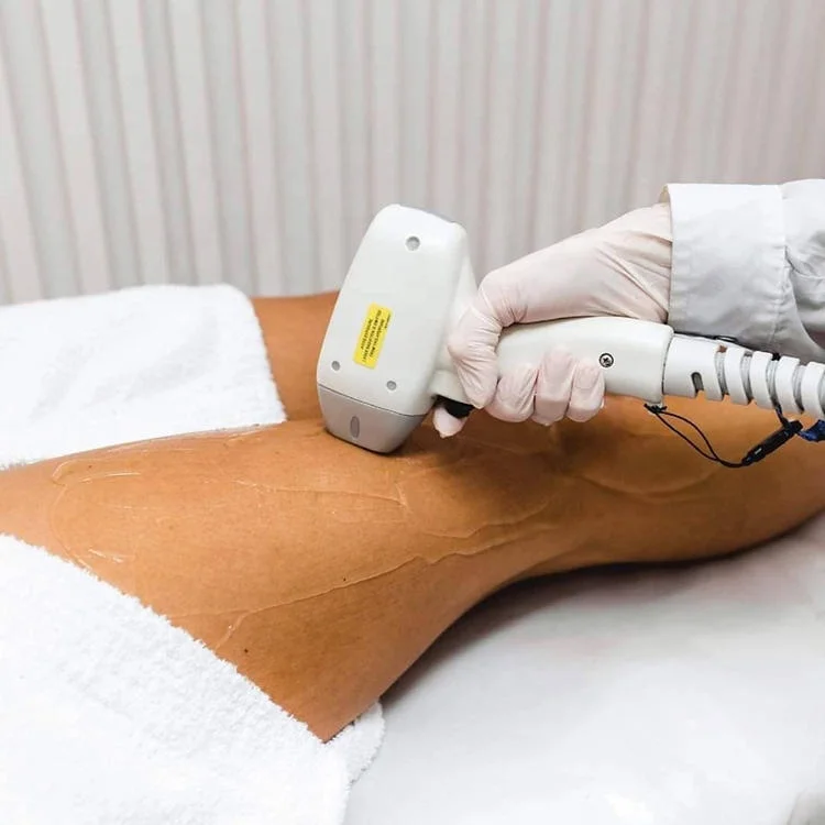 Laser Diode 808nm /808 Diode Laser Hair Removal Machine/808 Laser price