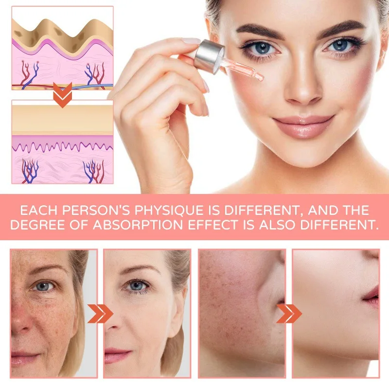 Private Logo Skin Lightening Smoothing Gel Aloe Vera Face Cream Natural Organic Pure Aloe Gel Face Care Repair Serum