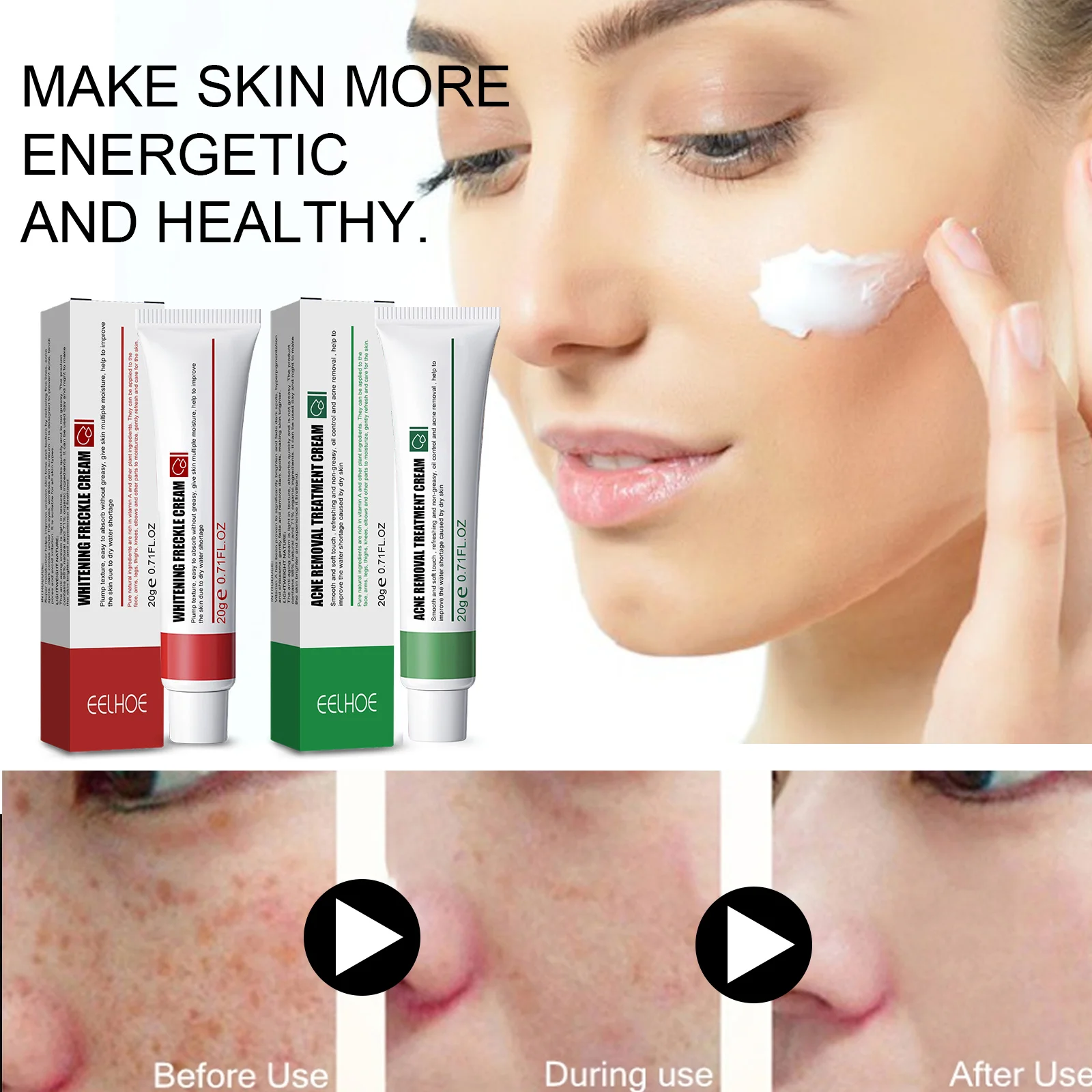 Effective Acne Removal Cream Herbal Acne Spots Oil Control Acne Cream Skin Care Whitening Moisturizing Face Gel Skin Care 20g