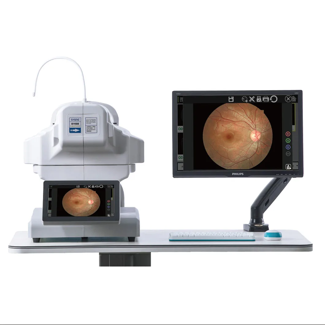 Цифровой полностью автоматизированная Non-мидриатические фундус-камера флуоресценции глазного дна